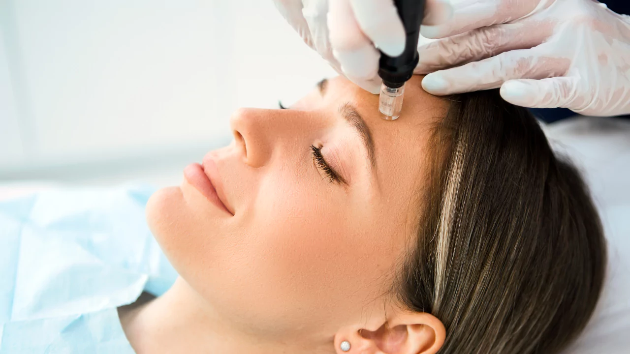 THE BEST MICRO NEEDLING NEAR ME