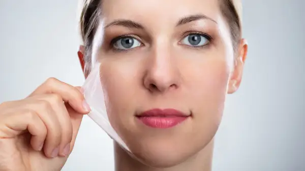 CHEMICAL PEELS NEAR ME