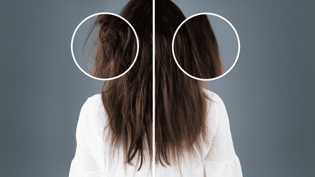 Bare Elegance Aesthetics _ Incredible Hair Restoration Services Near Me