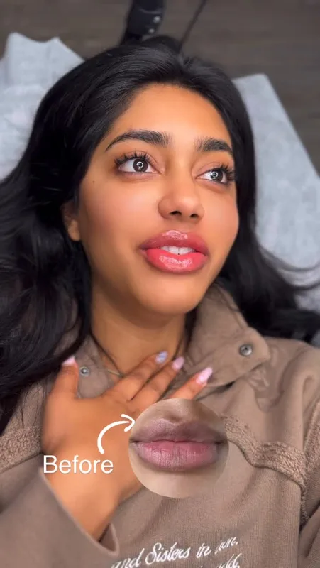 Healed lip blush — from the Dr Browz Instagram