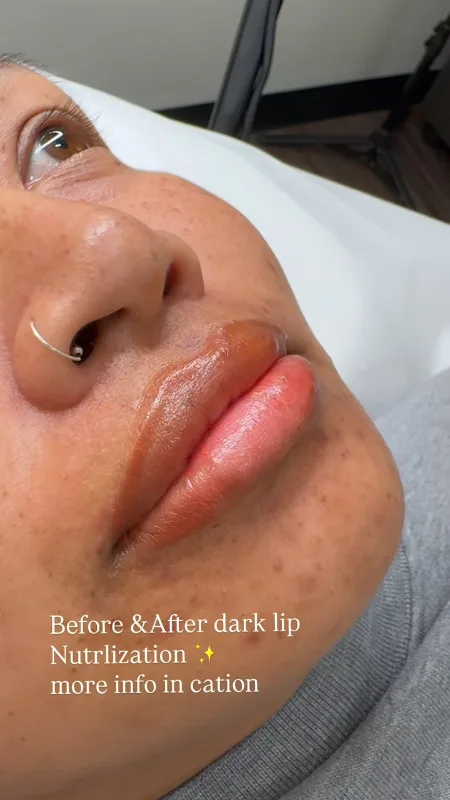 Dark lip neutralization — from the Dr Browz Instagram