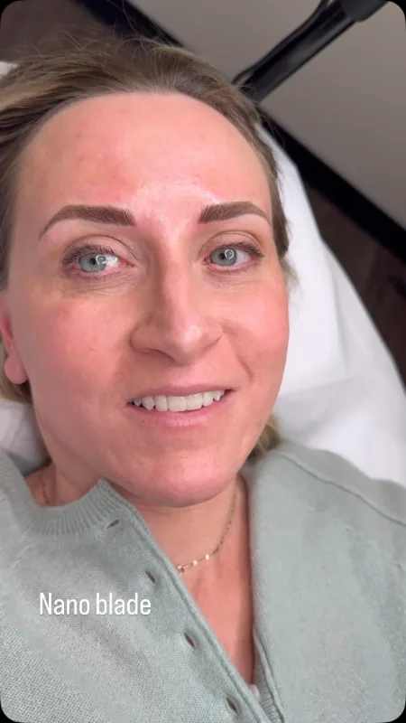 Nano strokes — from the Dr Browz Instagram
